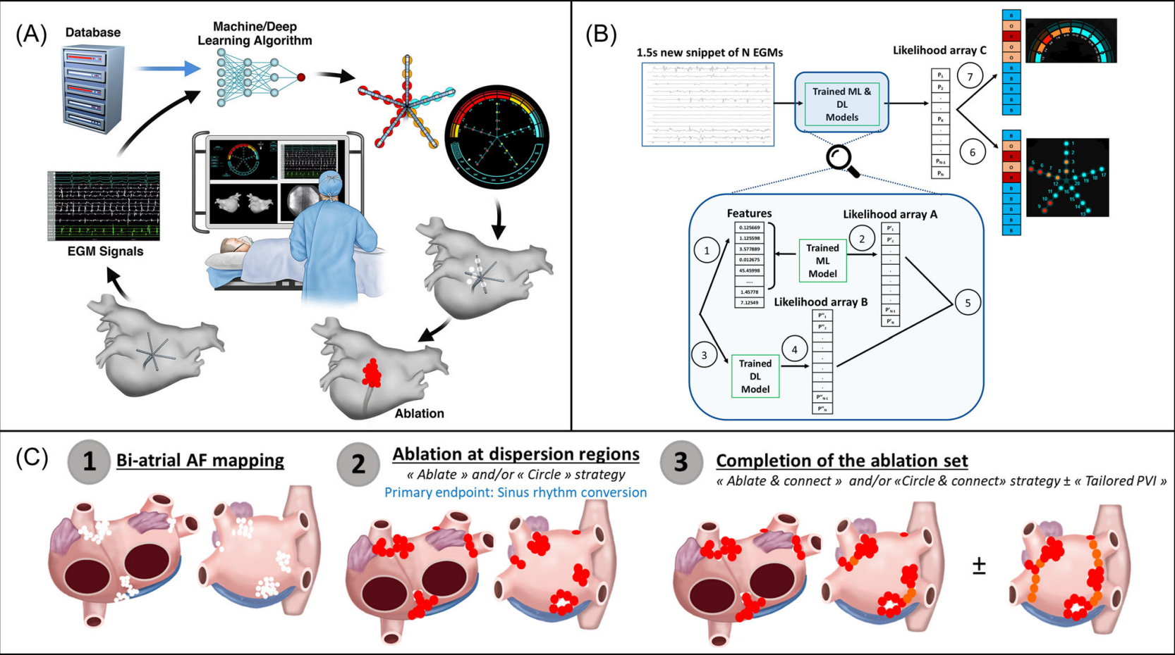 房颤消融异常识别示例