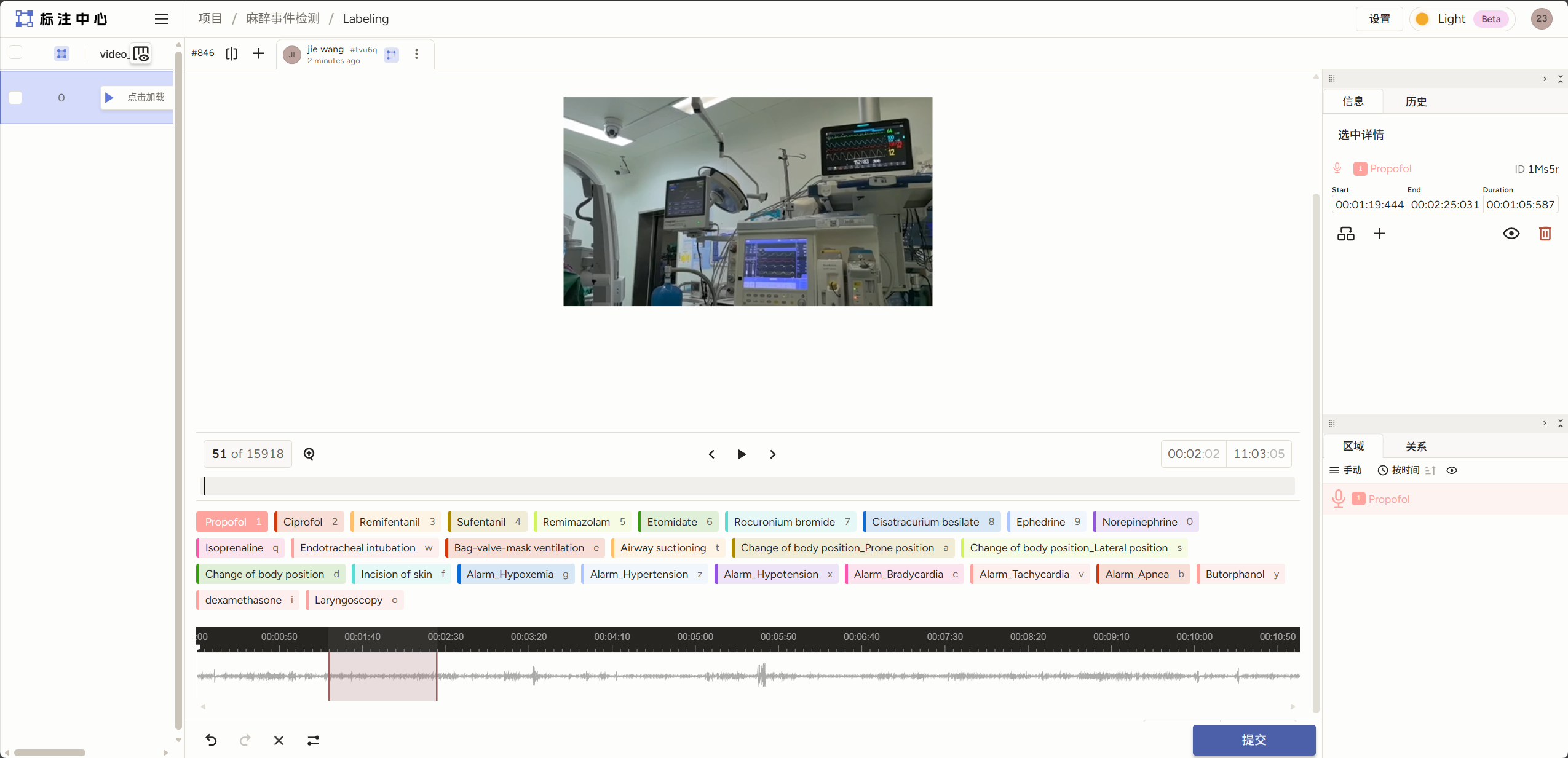 麻醉大模型示例